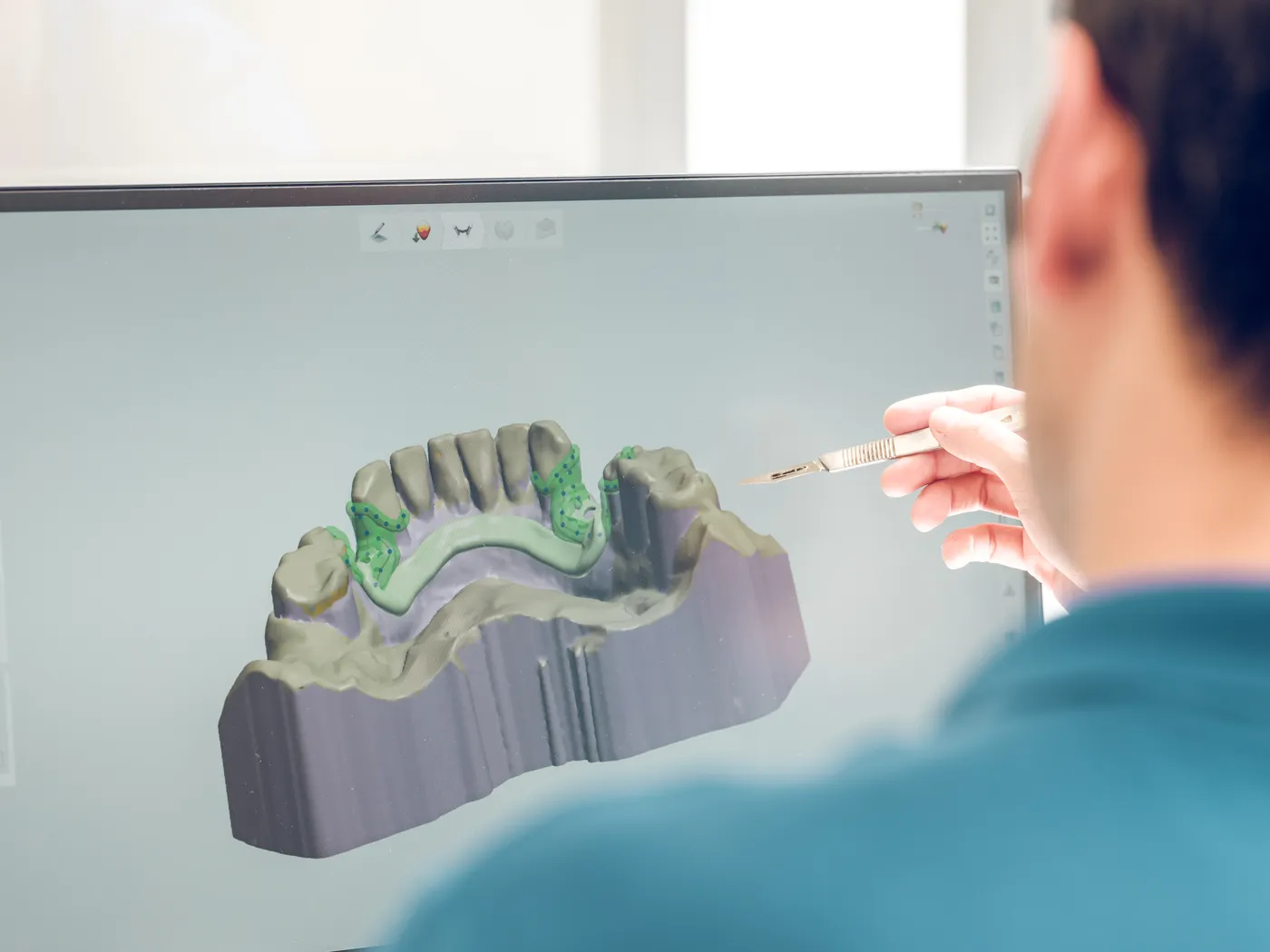 3D 임플란트 식립 계획 설계